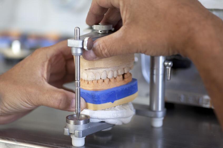 Dwie dłonie lekarza, które próbują dopasować zgryz sztucznej szczęki na urządzeniu dentystycznym.