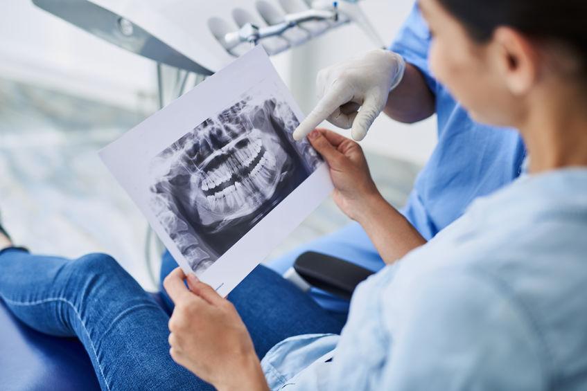 Dwoje stomatologów oglądających zdjęcie RTG szczęki. Jeden lekarz siedzi i trzyma w dłoni zdjęcie a drugi stoi i pokazuje palcem w strone zdjęcia.