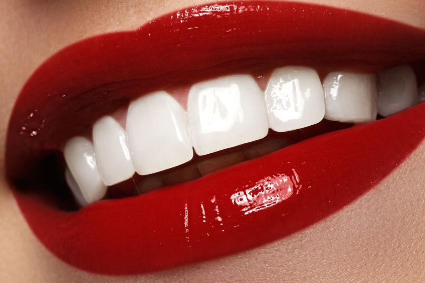 Uśmiechnięte, czerwone usta kobiety, pokazujące wspaniałe białe zęby.